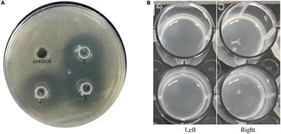 A pilot study on the efficacy of topical lotion containing anti-acne postbiotic in subjects with mild -to -moderate acne